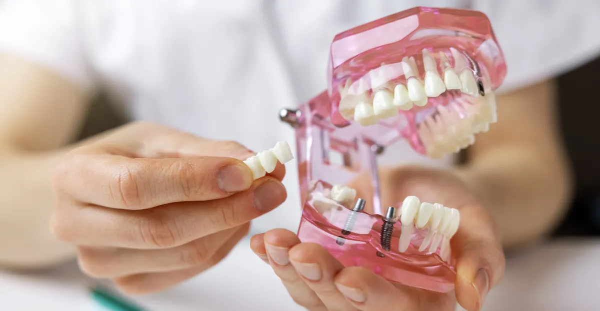 Dental Implants in Albany: A Patient’s Guide to the Process