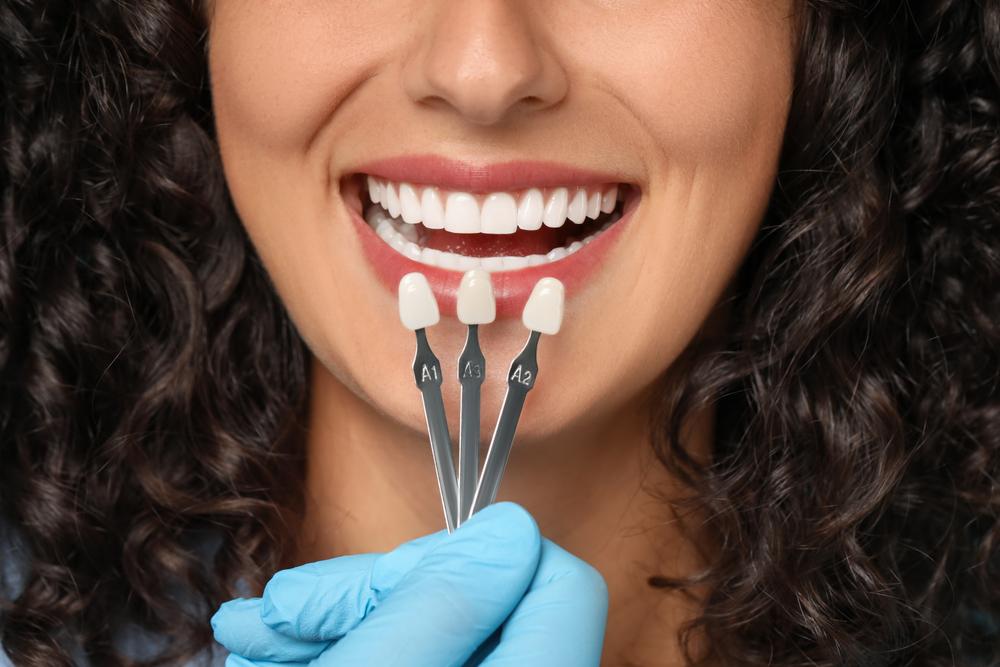 Reveal A Flawless Smile With Veneers